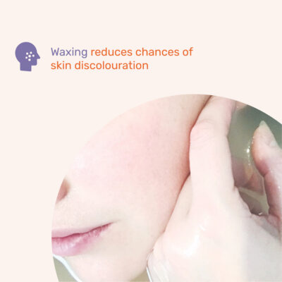 No discoloration